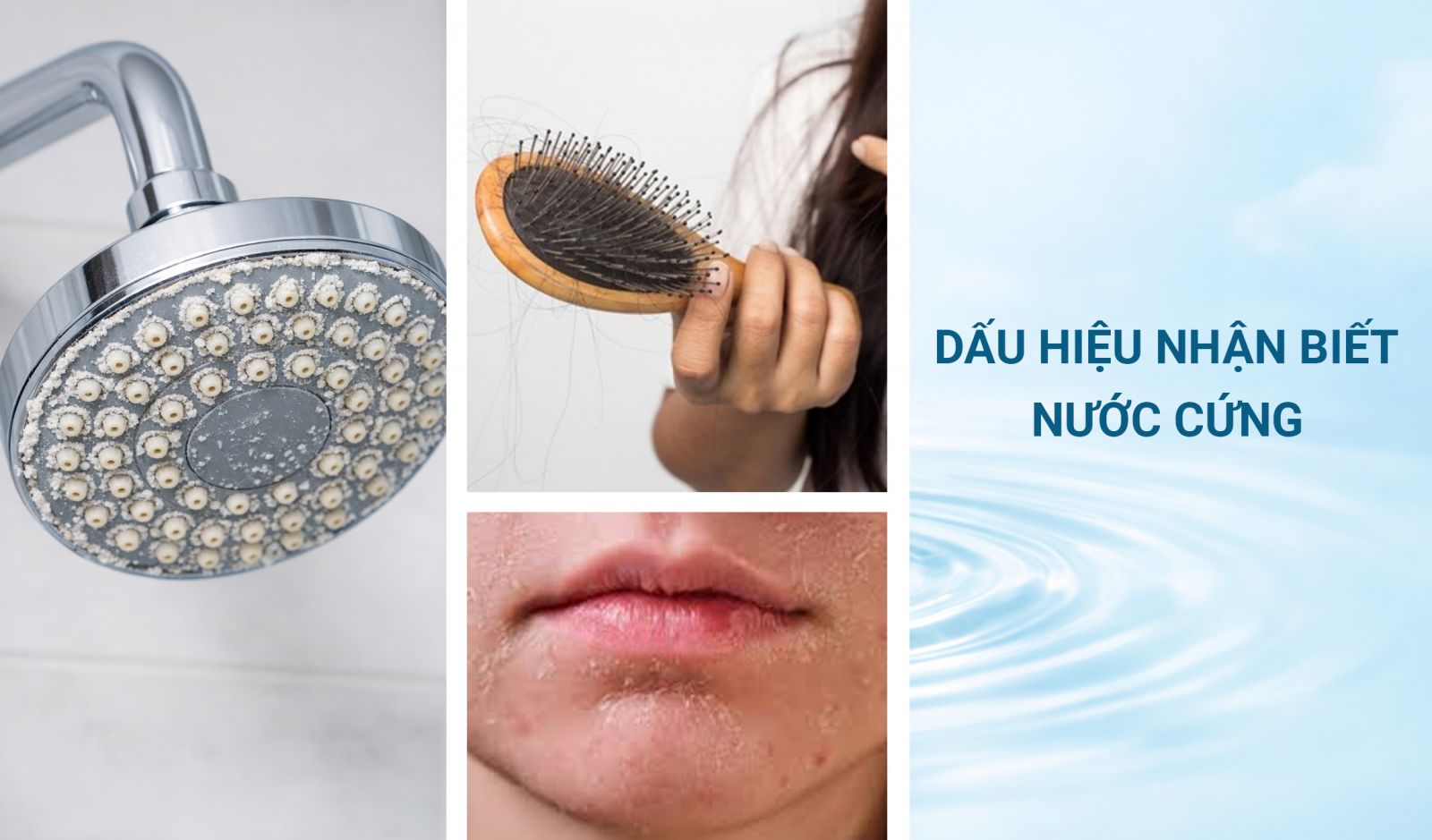 Vòi sen bám cặn, da khô, rụng tóc là dấu hiệu nhận biết nước cứng tại nhà